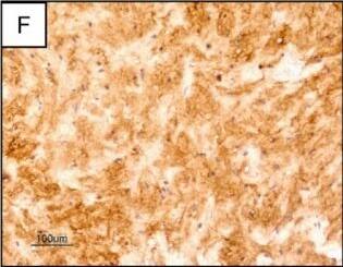 Detection of Human SCGF/CLEC11a by Immunohistochemistry