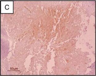 Detection of Human SCGF/CLEC11a by Immunohistochemistry