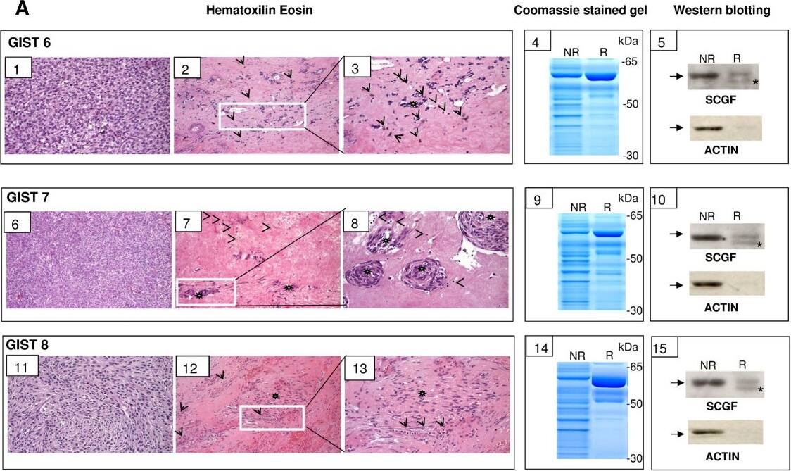 Detection of Human SCGF/CLEC11a by Western Blot