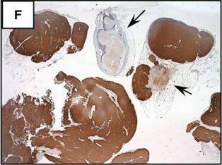 Detection of Human SCGF/CLEC11a by Immunohistochemistry