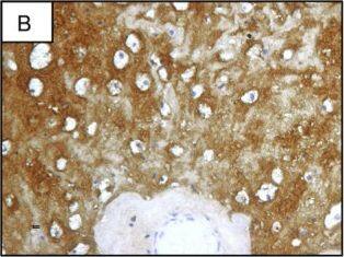 Detection of Human SCGF/CLEC11a by Immunohistochemistry