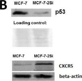 Detection of Human CXCR5 by Western Blot