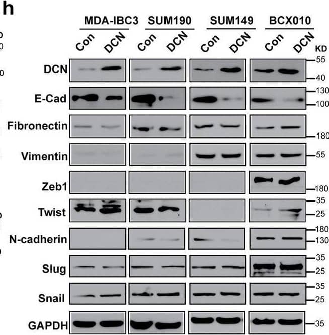 Detection of Fibronectin by Western Blot