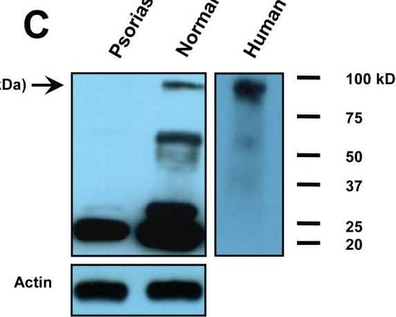 Detection of Plasminogen by Western Blot