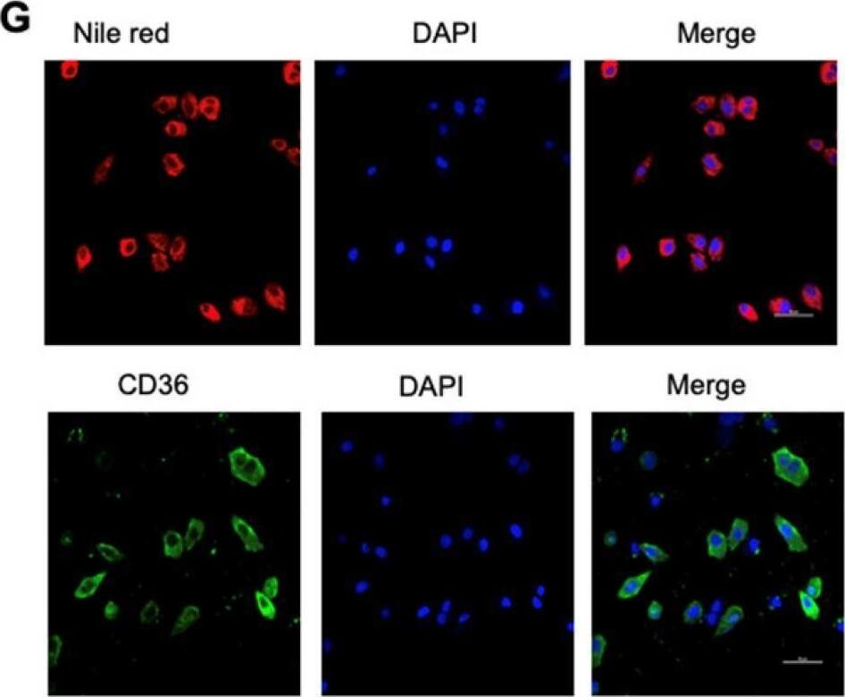 Detection of CD36/SR-B3 by Immunocytochemistry/ Immunofluorescence