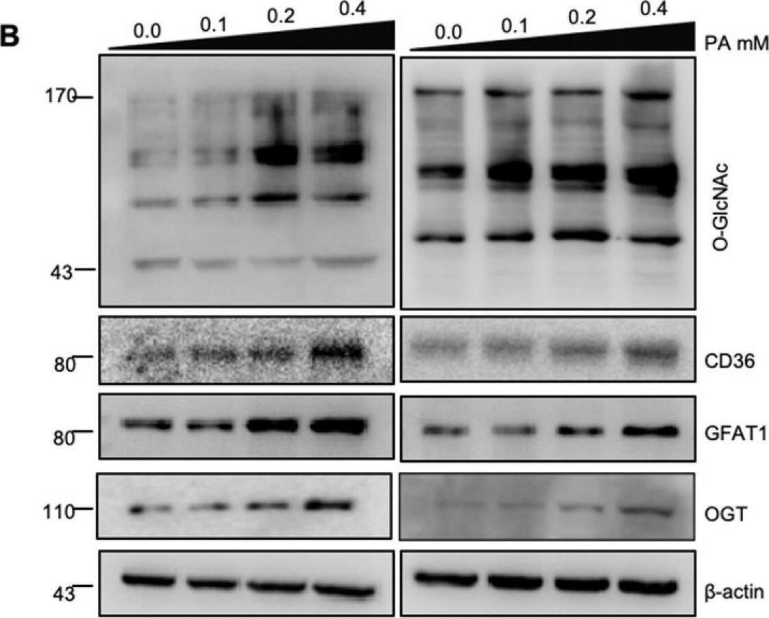 Detection of CD36/SR-B3 by Western Blot