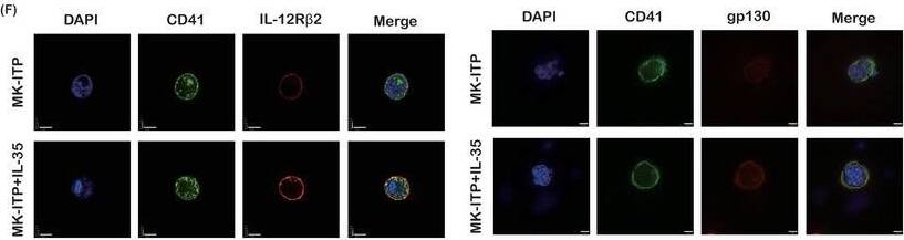 Detection of Human IL-12 R beta2 by Immunocytochemistry/ Immunofluorescence