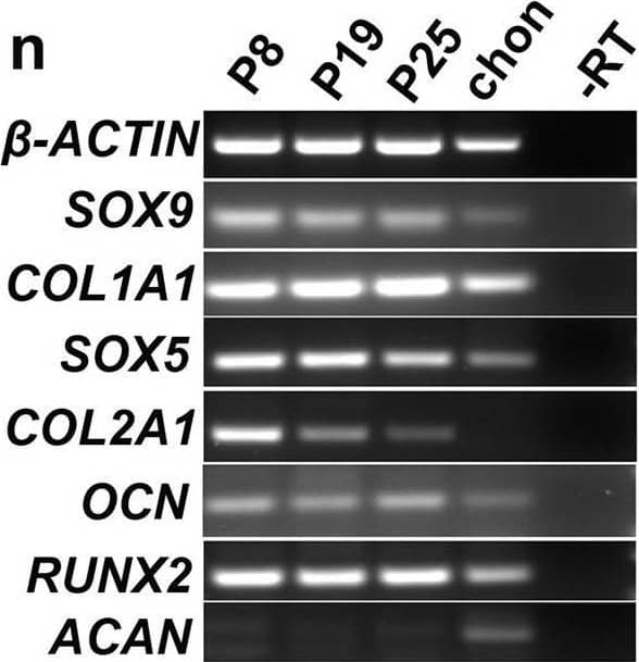 Detection of RUNX2/CBFA1 by Western Blot