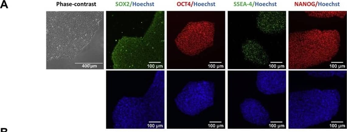 Detection of Human Human/Mouse/Rat SOX2 Antibody by Immunocytochemistry/ Immunofluorescence