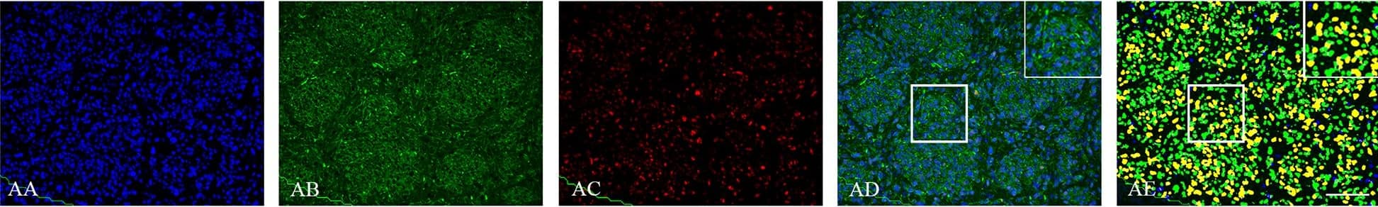 Detection of Human SOX2 by Immunocytochemistry/Immunofluorescence
