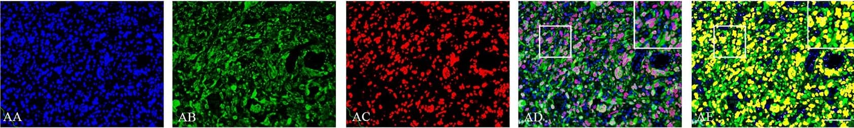Detection of Human SOX2 by Immunocytochemistry/Immunofluorescence