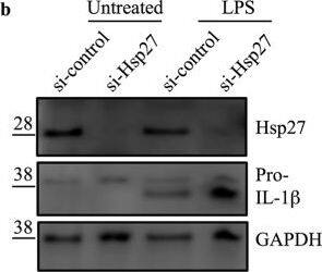 Detection of Human IL-1 beta/IL-1F2 by Western Blot