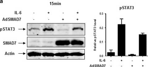 Detection of Human Human/Mouse/Rat Smad7 Antibody by Western Blot