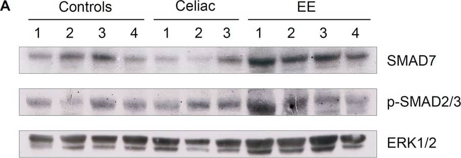 Detection of Human Human/Mouse/Rat Smad7 Antibody by Western Blot