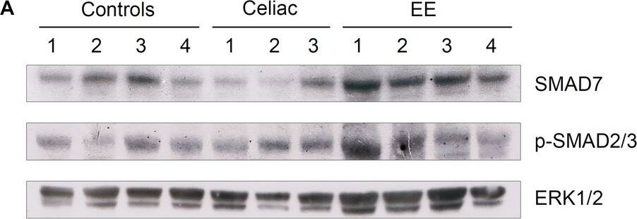 Detection of Human Smad7 by Western Blot