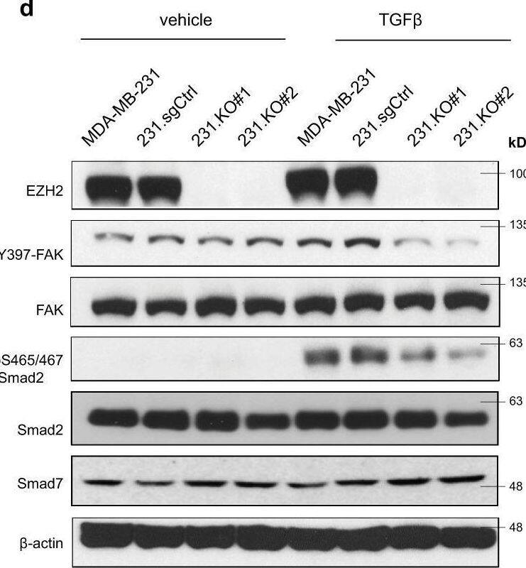Detection of Human Smad7 by Western Blot