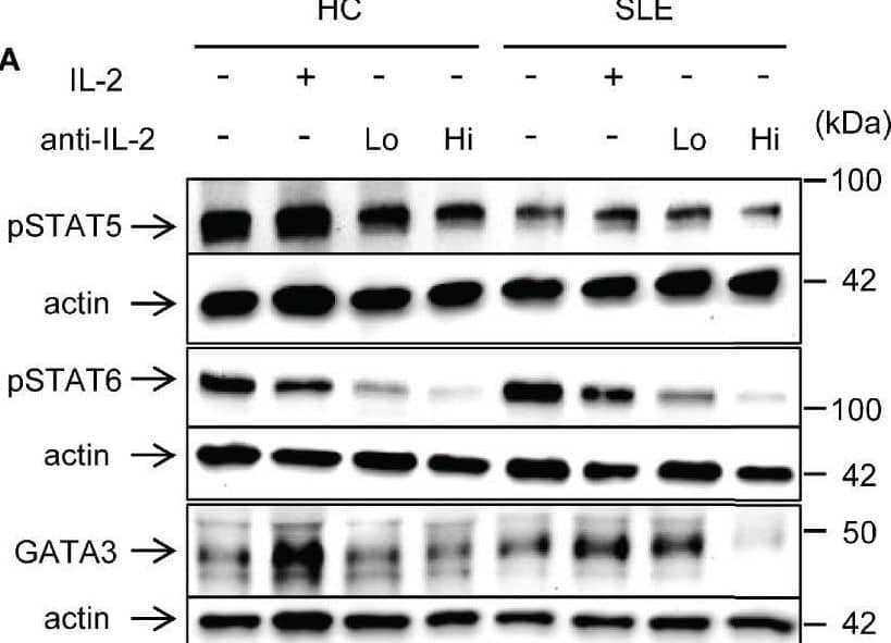 Detection of Human IL-2 by Western Blot