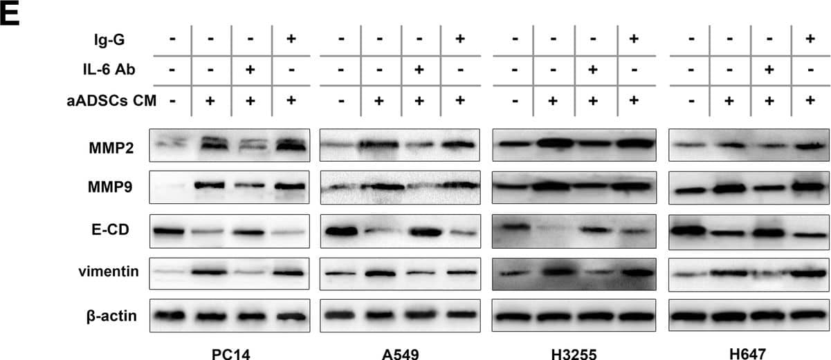Detection of Human IL-6 by Western Blot