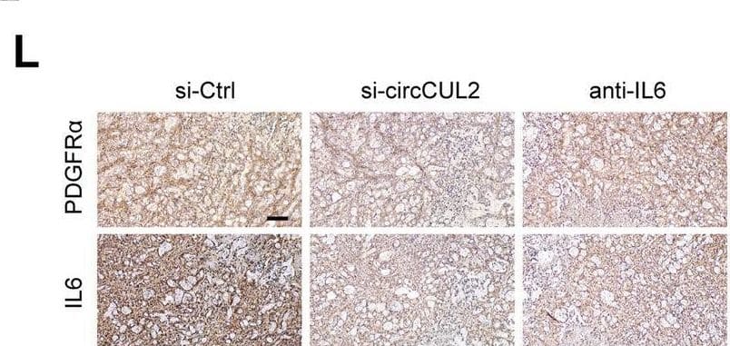 Detection of IL-6 by Immunohistochemistry
