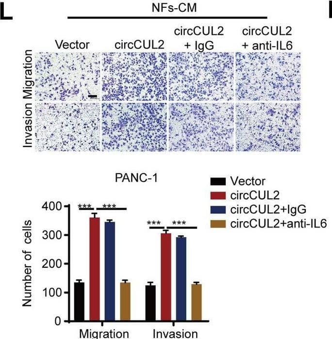 Detection of IL-6 by Immunohistochemistry