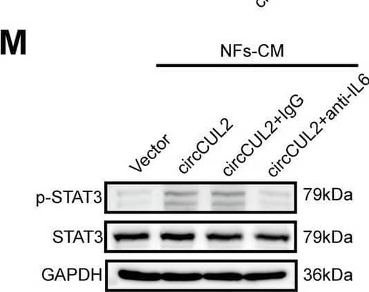 Detection of IL-6 by Western Blot