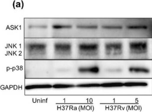 Detection of Human JNK1/JNK2 by Western Blot