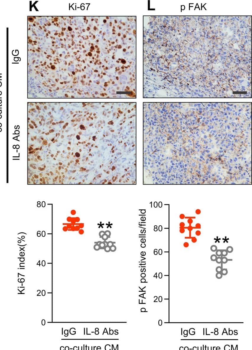 Detection of IL-8/CXCL8 by Immunohistochemistry