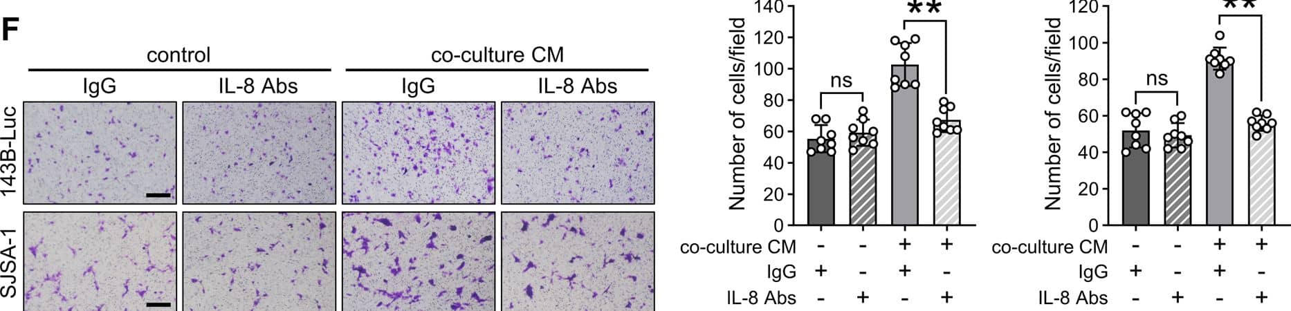 Detection of IL-8/CXCL8 by Immunohistochemistry
