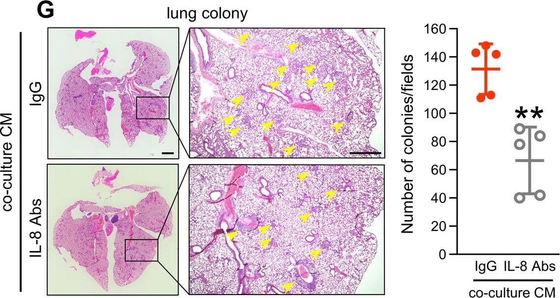 Detection of IL-8/CXCL8 by Immunohistochemistry