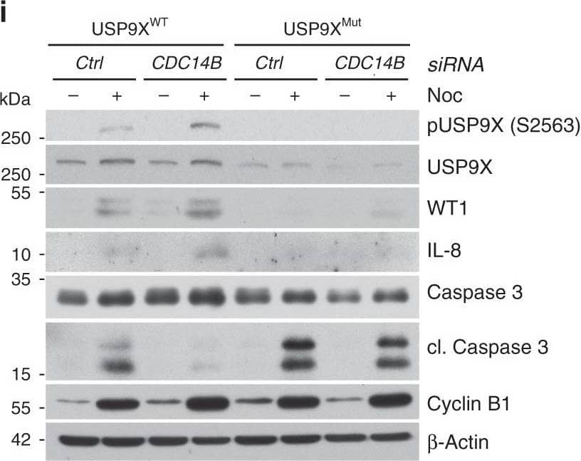 Detection of IL-8/CXCL8 by Western Blot