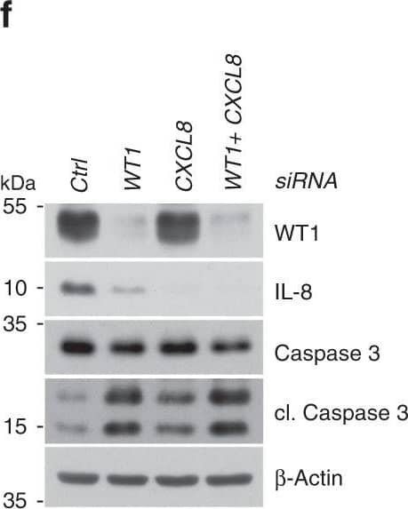 Detection of IL-8/CXCL8 by Western Blot