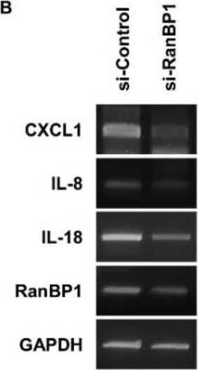 Detection of IL-8/CXCL8 by Western Blot