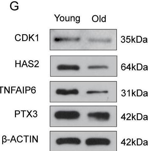 Detection of TSG-6 by Western Blot