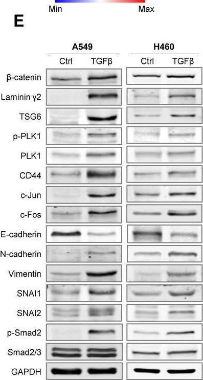 Detection of TSG-6 by Western Blot