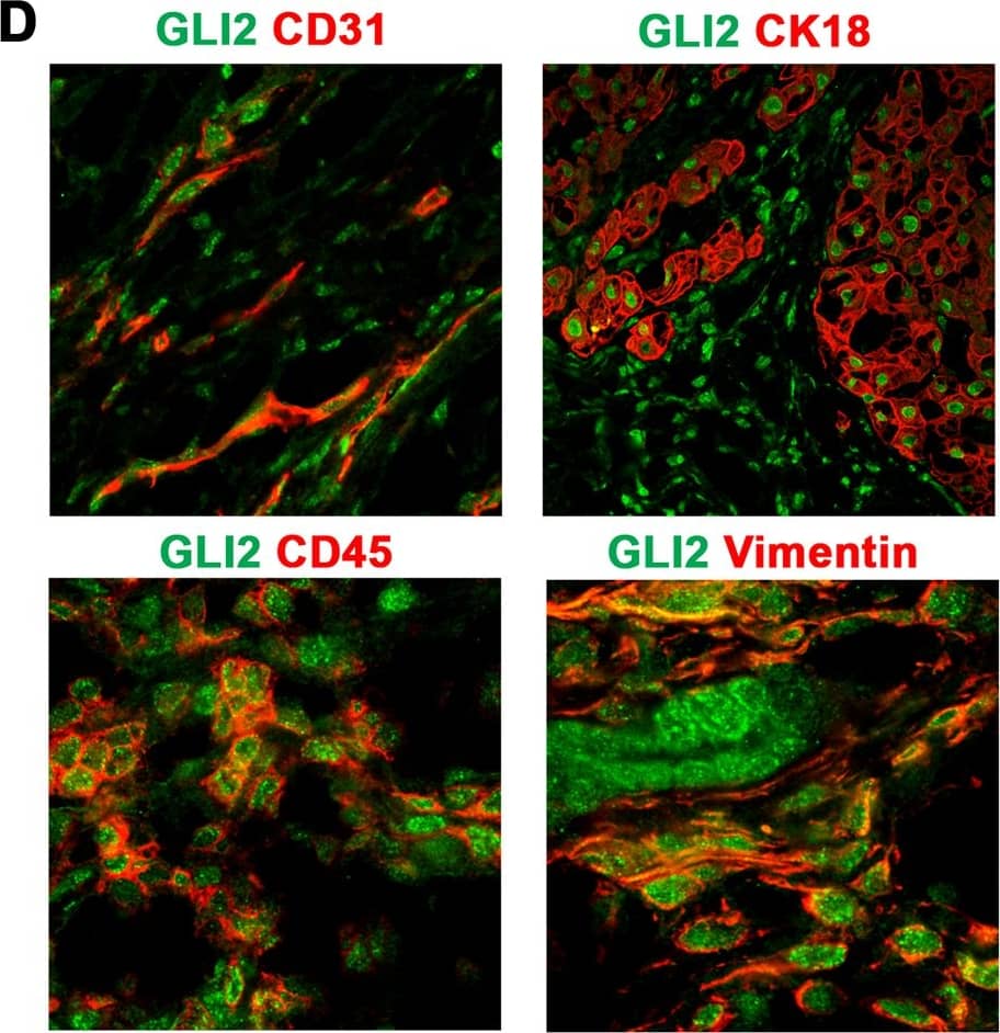 Detection of Human Vimentin by Immunocytochemistry/Immunofluorescence