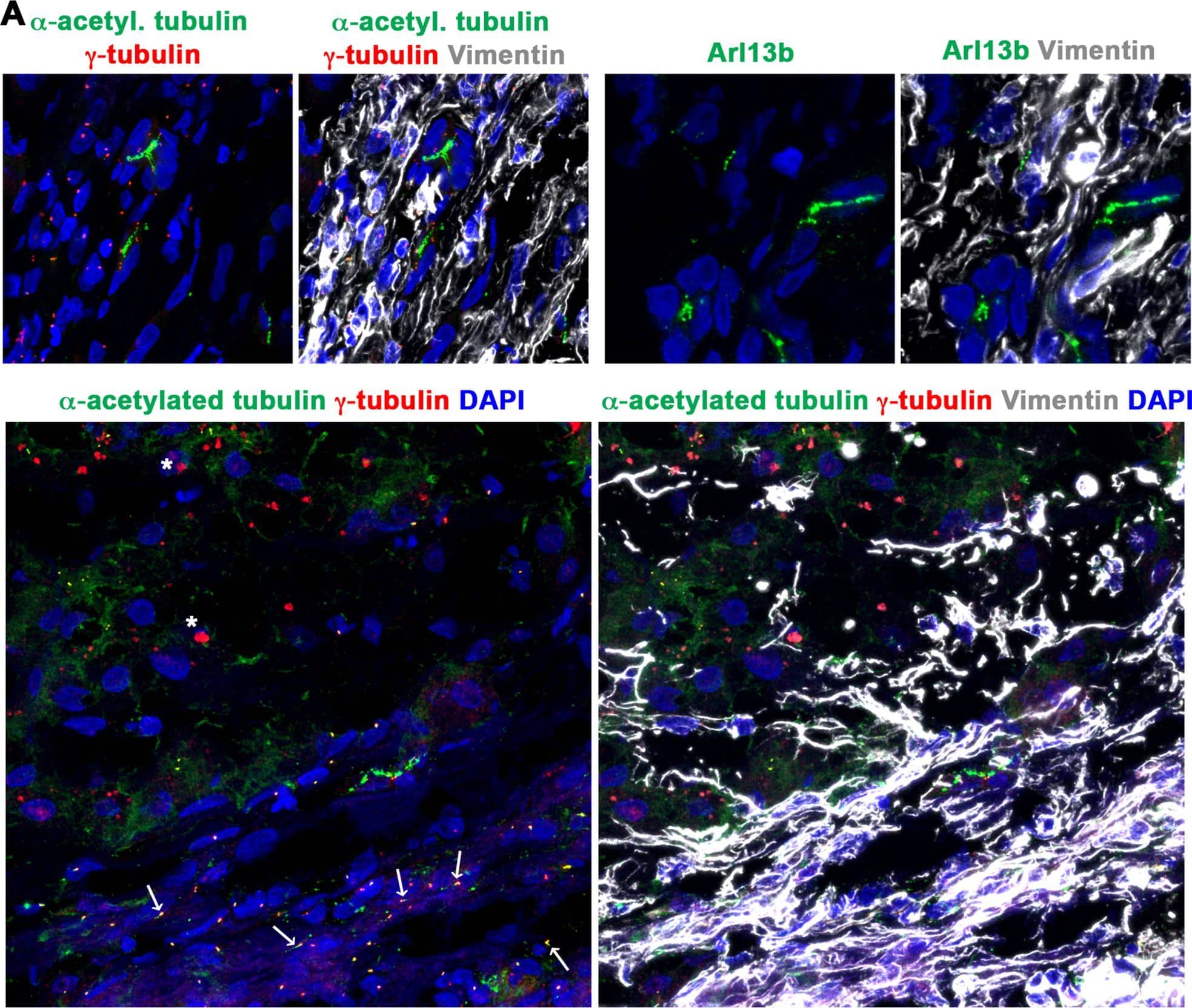 Detection of Human Vimentin by Immunocytochemistry/Immunofluorescence