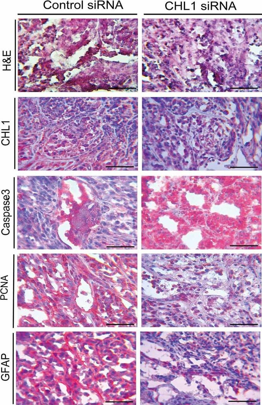 Detection of Human CHL-1/L1CAM-2 by Immunohistochemistry