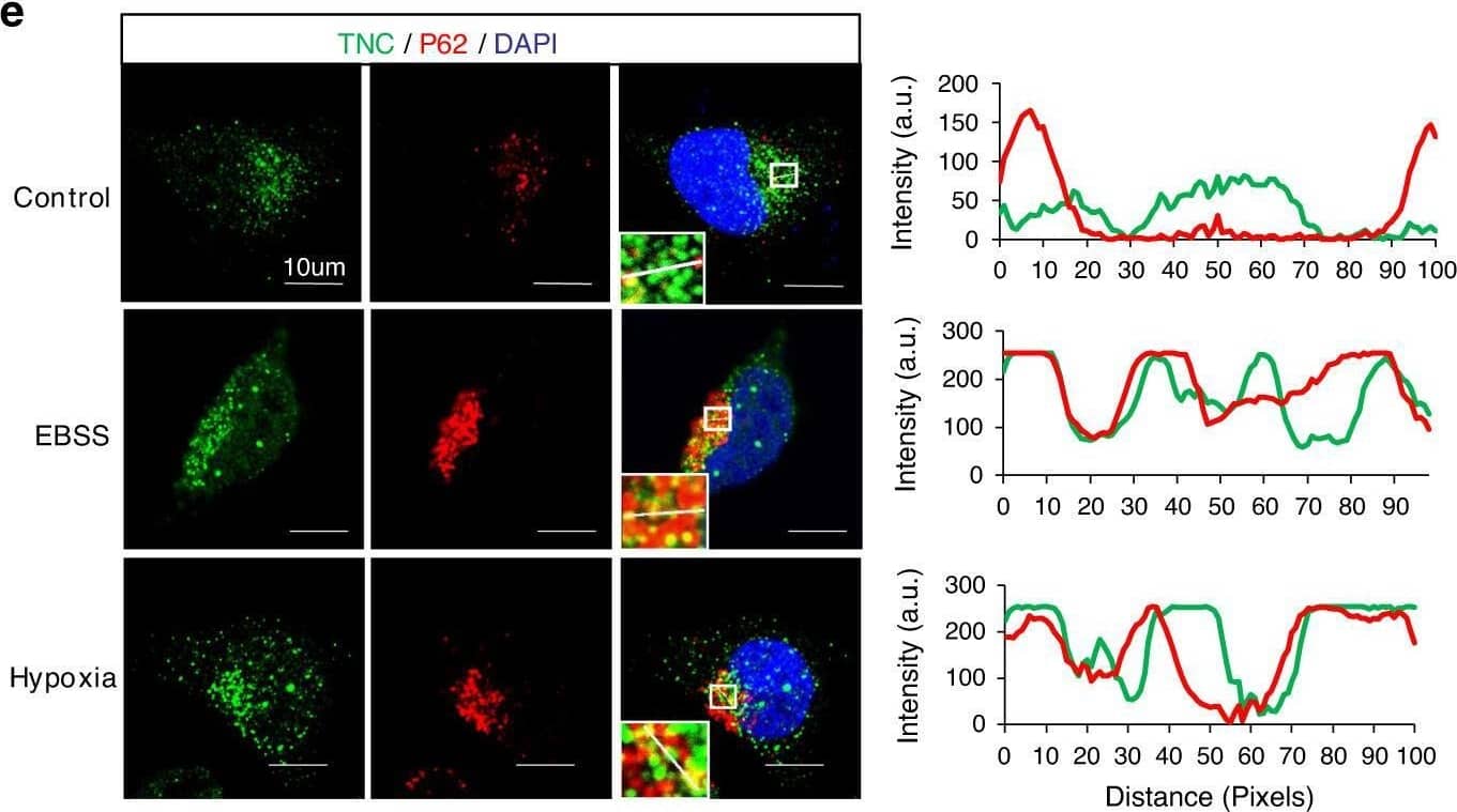 Detection of Tenascin C by Immunocytochemistry/ Immunofluorescence