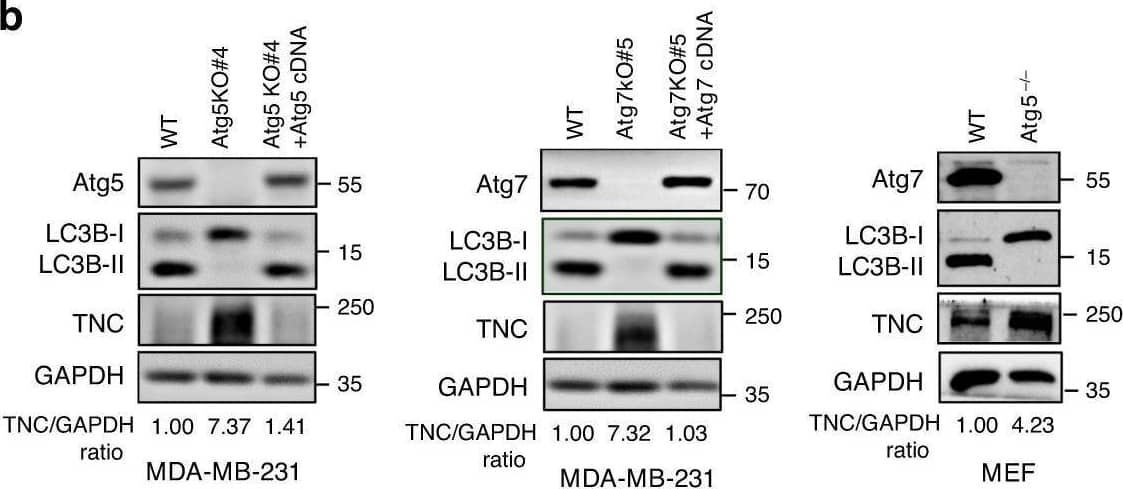 Detection of Tenascin C by Western Blot