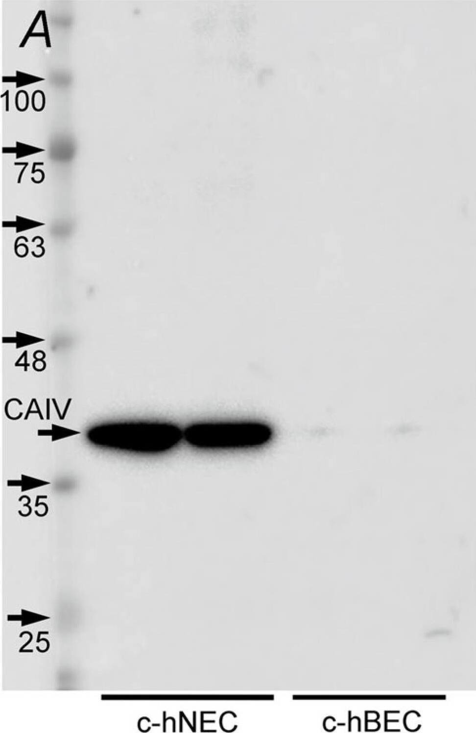Detection of Human Carbonic Anhydrase IV/CA4 by Western Blot