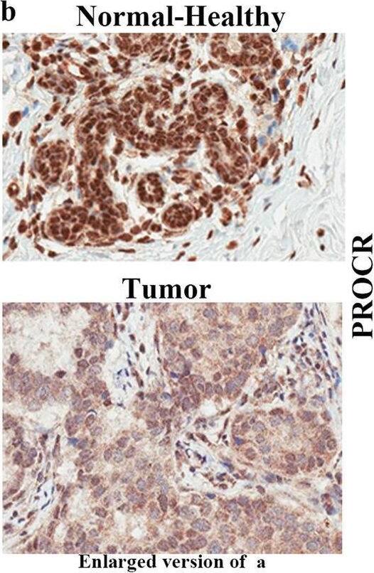 Detection of EPCR by Immunohistochemistry