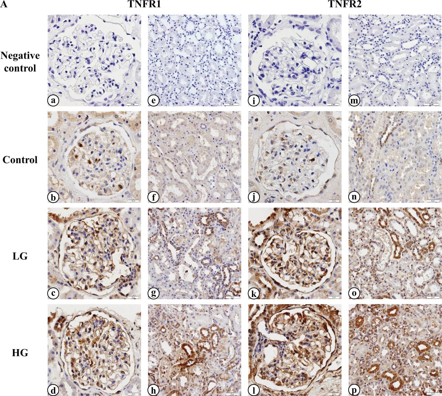 Detection of Human TNF RII/TNFRSF1B by Immunohistochemistry
