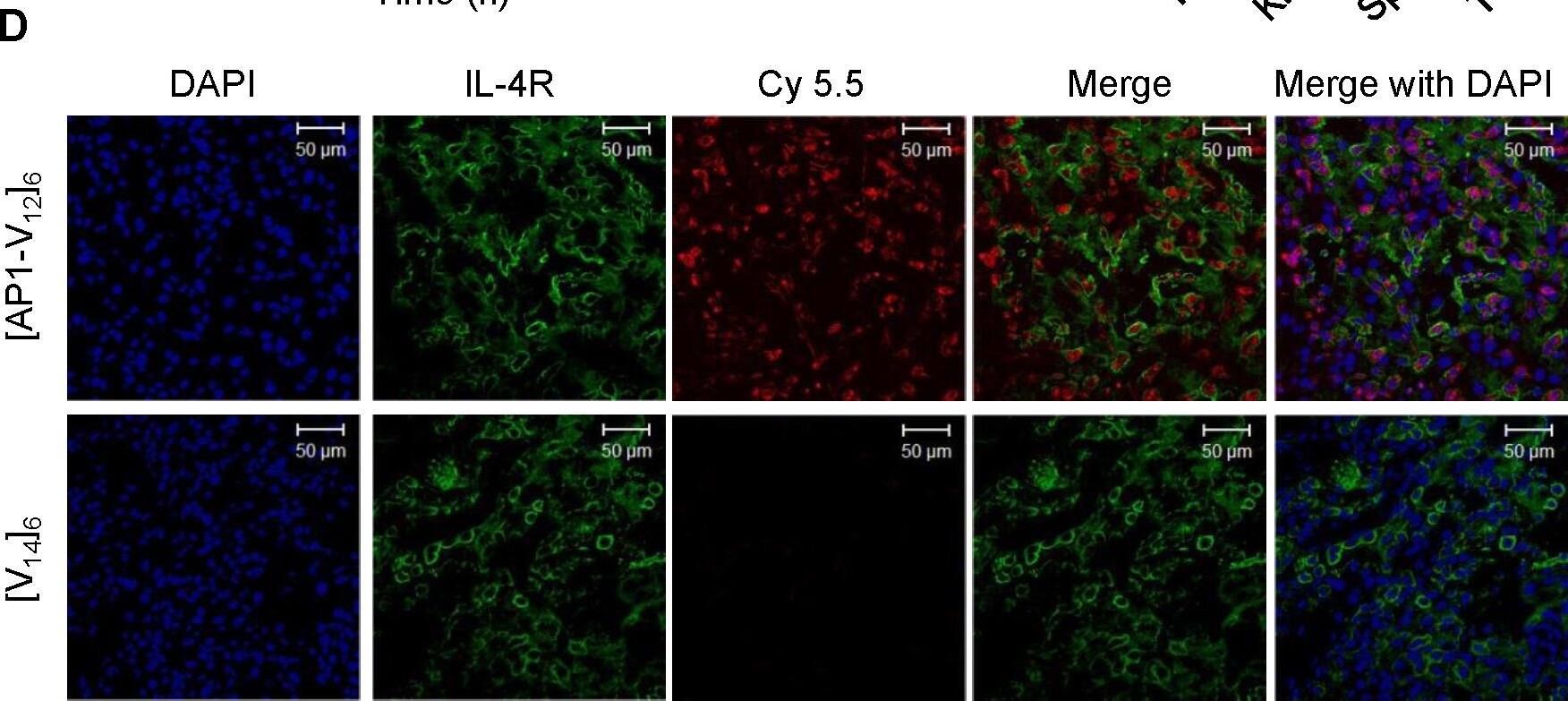 Detection of Human IL-4R alpha by Immunocytochemistry/Immunofluorescence