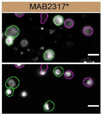 SHIP Specificity is Shown by Immunocytochemistry in Knockout Cell Line.