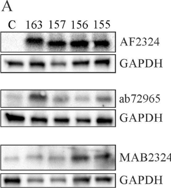 Detection of Chemerin by Western Blot
