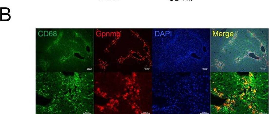 Detection of Osteoactivin/GPNMB by Immunohistochemistry