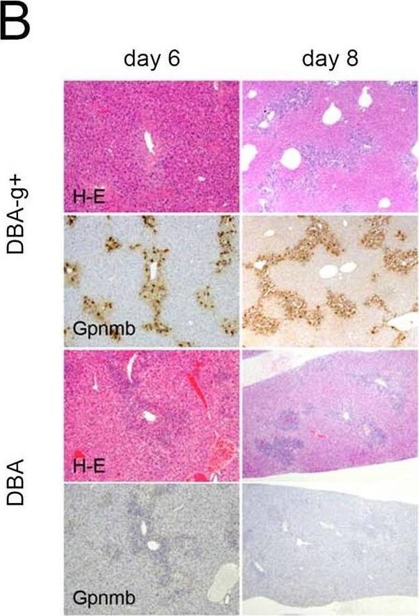 Detection of Osteoactivin/GPNMB by Immunohistochemistry
