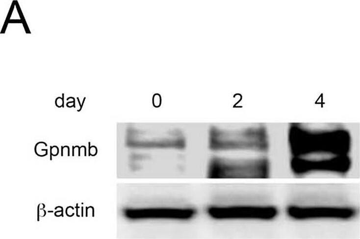 Detection of Osteoactivin/GPNMB by Western Blot