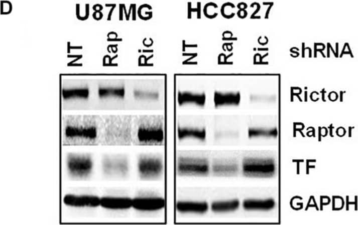 Detection of Coagulation Factor III/Tissue Factor by Western Blot
