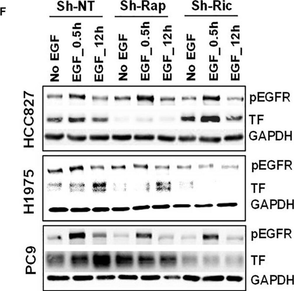 Detection of Coagulation Factor III/Tissue Factor by Western Blot